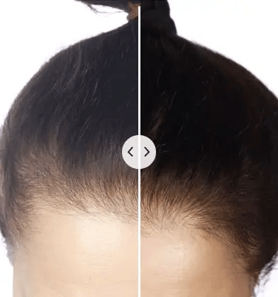 ChicBlend | Multifunktionel hårkam med hovedbundsmassage og stylingfunktion 4