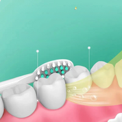 CleanFlex - Ikke-genopladelig sonisk tandbørste til et friskt smil 4