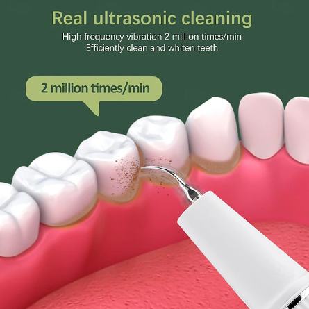 Dentora | Professionel ultralyds tandstensfjerner til effektiv tandpleje derhjemme 3