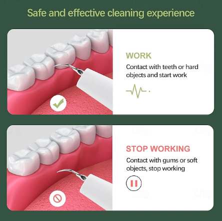 Dentora | Professionel ultralyds tandstensfjerner til effektiv tandpleje derhjemme 4