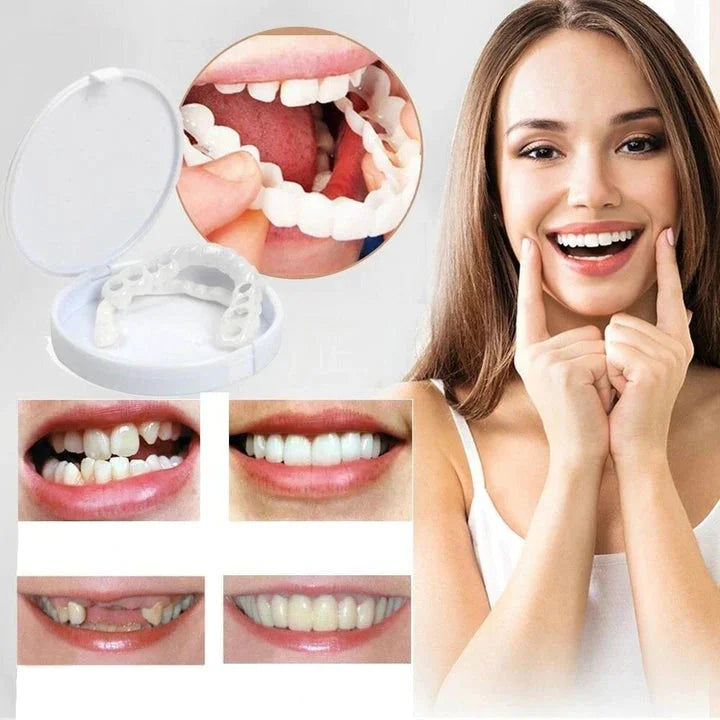 Øjeblikkelig smilforvandling med Snap-on Smile Facader 1