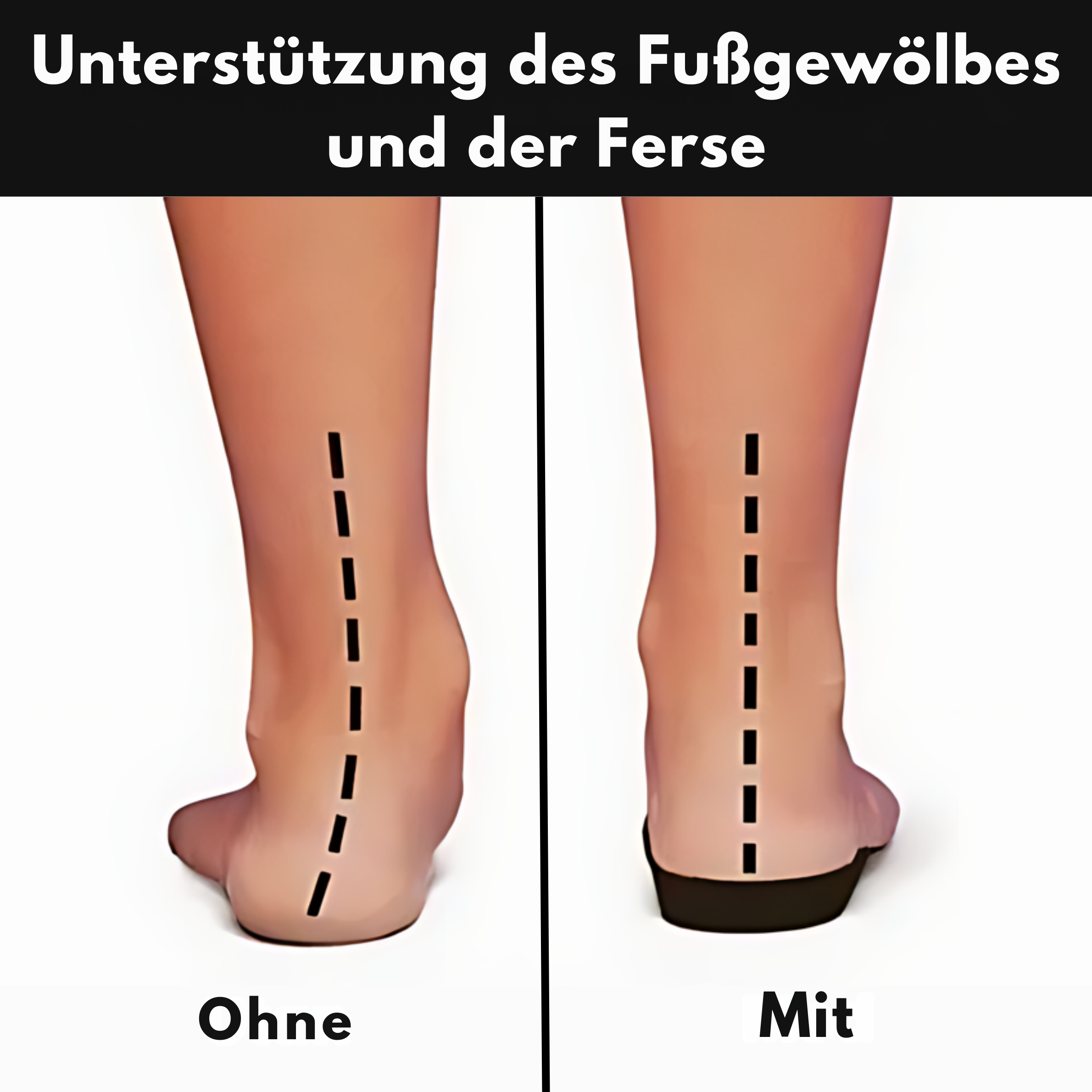 Ortopædiske Sko Med Arch Support Til Kvinder - Komfort Hele Dagen, Slip-On Design 8