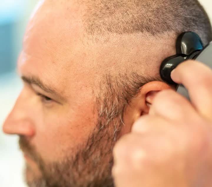 SmoothTrim | Multifunktionel elektrisk trimmer med flydende bladsystem 5