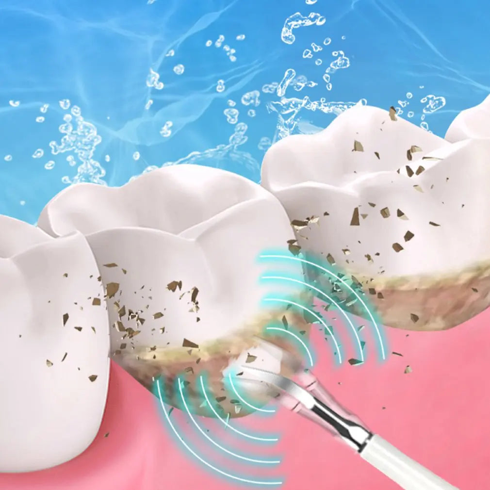 SparkSonic - Sonisk tandrenser og blegnings-irrigator 2