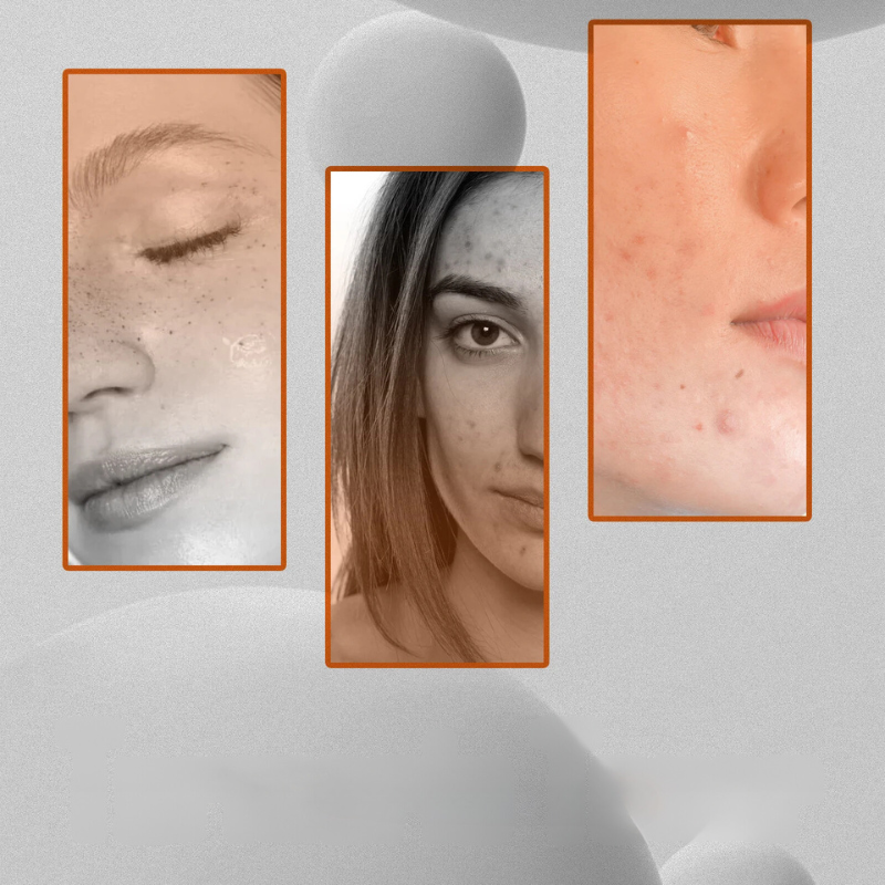 Spotless Glow Toner – Mørkpletkorrigerer og lysnende ansigtspleje 2